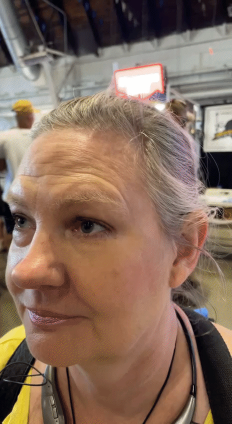 Easy Eye Lift Solution