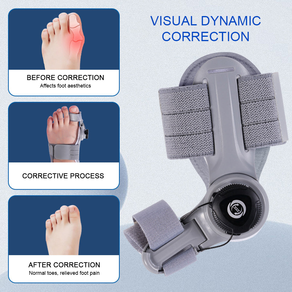 Align™ Bunion Corrector